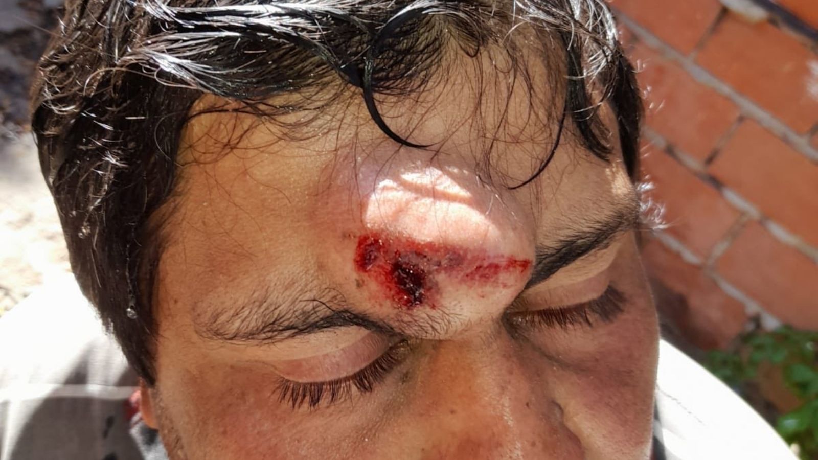 no quiso comprar medias a un vendedor y le partieron un adoquín en la frente