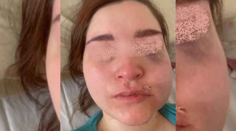 Solano: sigue prófugo el joven acusado de atacar a su pareja y a su bebé en Solano