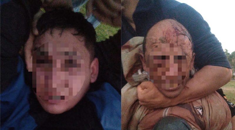 Plátanos | Atacaron a madre e hija cuando iban al colegio, pero fueron atrapados por los vecinos