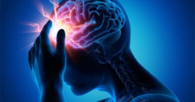 Epilepsia